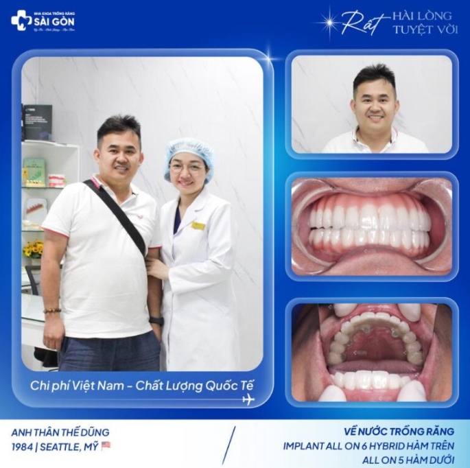 Trồng răng Implant tại Nha khoa trồng răng Sài Gòn